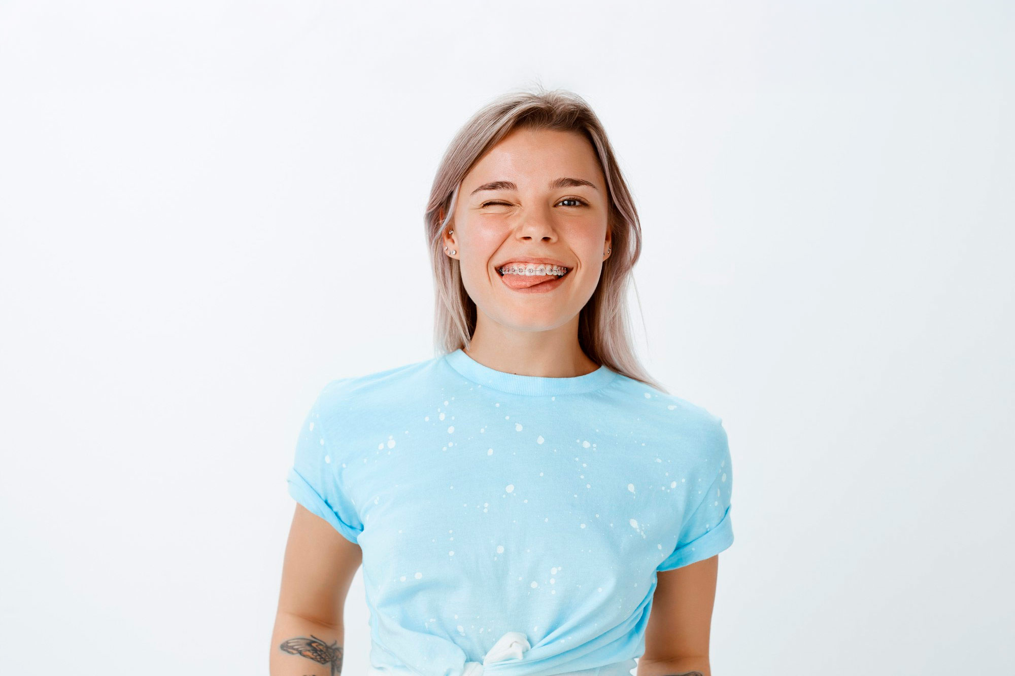 ortodoncia-en-alicante