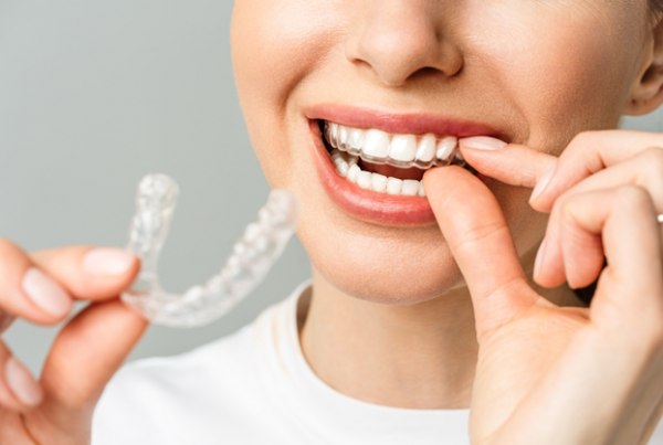 invisible-ortodoncia